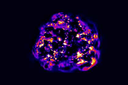 NANOTECHNOLOGY USES LIGHT TO SHOW DENSITY OF TUMORS