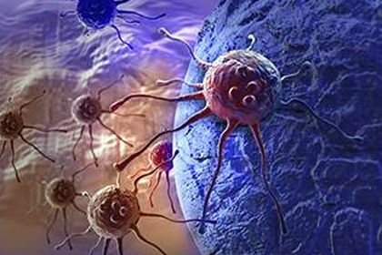 OPTIMAL TUMOR REDUCTION, PLATINUM SENSITIVITY CHARACTERIZE LONG-TERM OVARIAN CANCER SURVIVAL